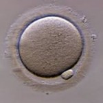 delayed fertility