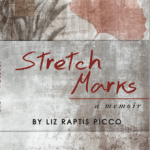 stretchmarks